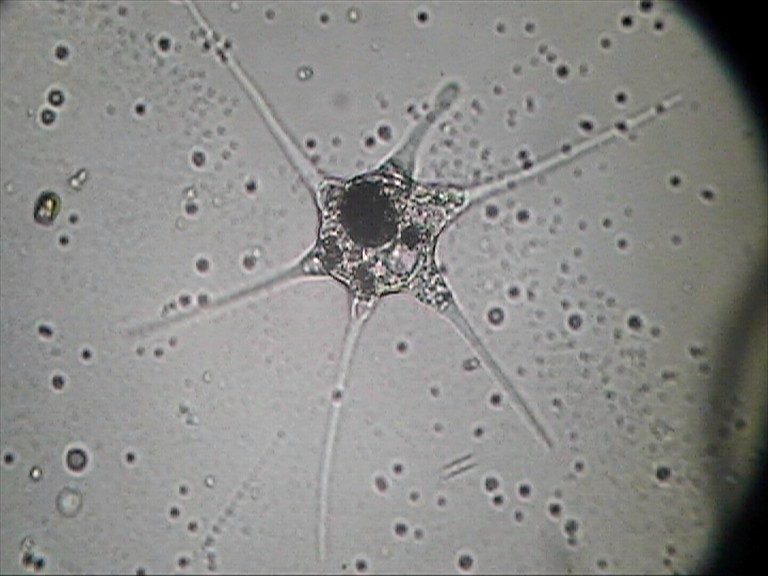 Astramoeba radiosa